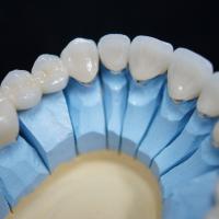 Gold Margins in Beautiful PFM's