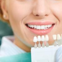 Porcelain Veneers