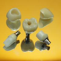 Zirconia implant Crowns and Abutments