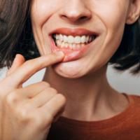 Dental Check-ups and Dental Cleanings